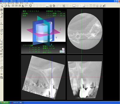 3DEpm}Xu@xr[G|bNX3D